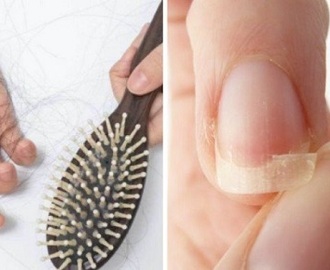 5 naturalnych składników, które pomogą Ci w walce z wypadającymi włosami i łamliwymi paznokciami.