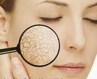 Dry Skin - Symptoms, Reasons and Home remedies.