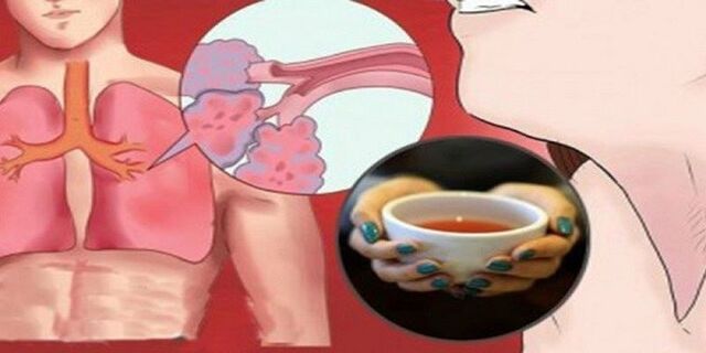 Pij tą herbatę, a pozbędziesz się flegmy z płuc i ukoisz objawy astmy