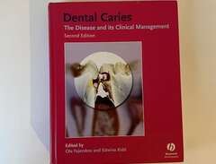 Dental Caries The disaese a...
